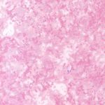 เสื่อน้ำมัน KF036-3